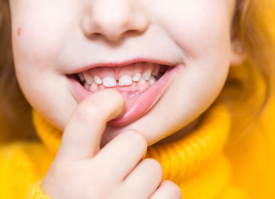 Frequently Asked Questions About Kids' Dental Health