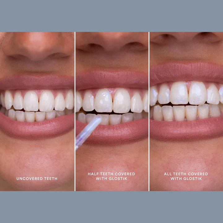 Hismile Glostik Tooth Gloss Before & After