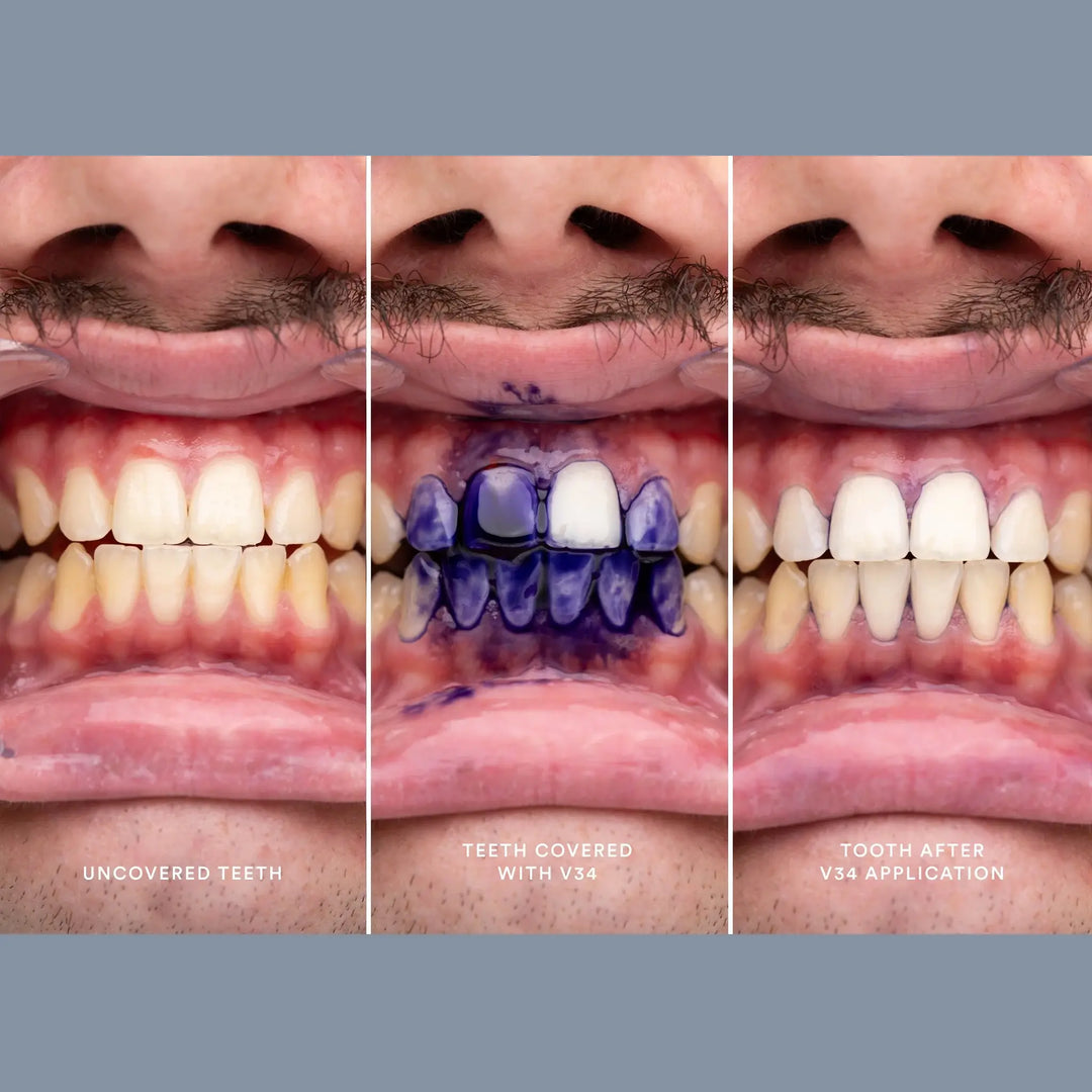Shop Hismile V34 Colour Corrector Serum Toothpasteology shop-hismile-v34-colour-corrector-serum-toothpasteology